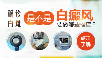 孩子白癜风症状